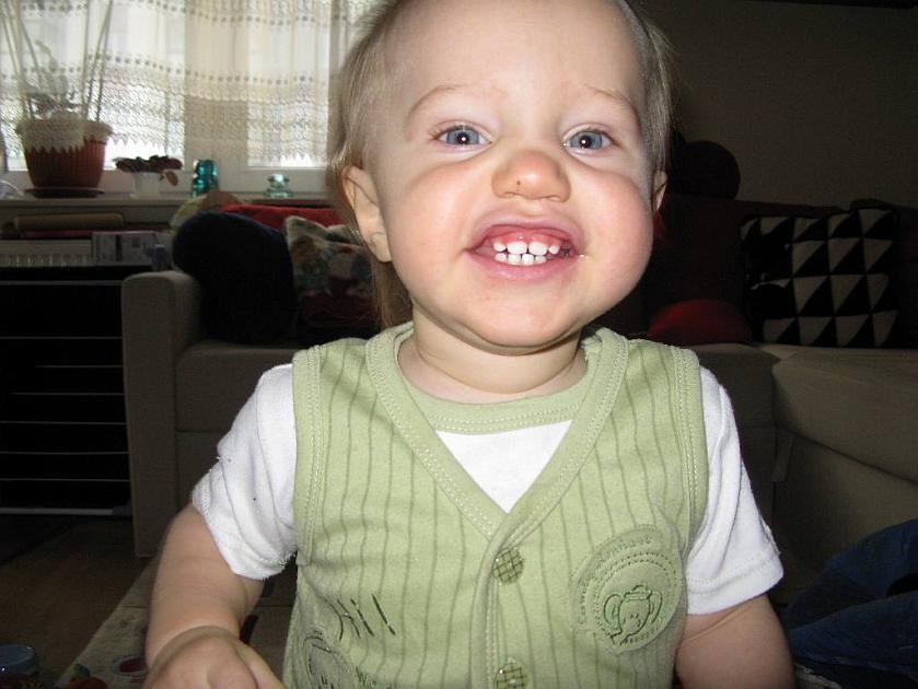 20081231-IMG_7368.JPG - Ale mam z�by!